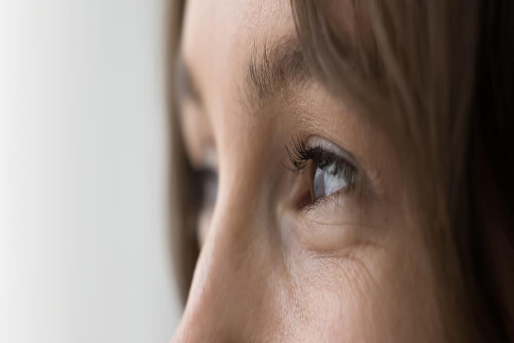 Close-up of a woman's eyes, showing fine lines and eyelid sagging, as she considers eyelid surgery