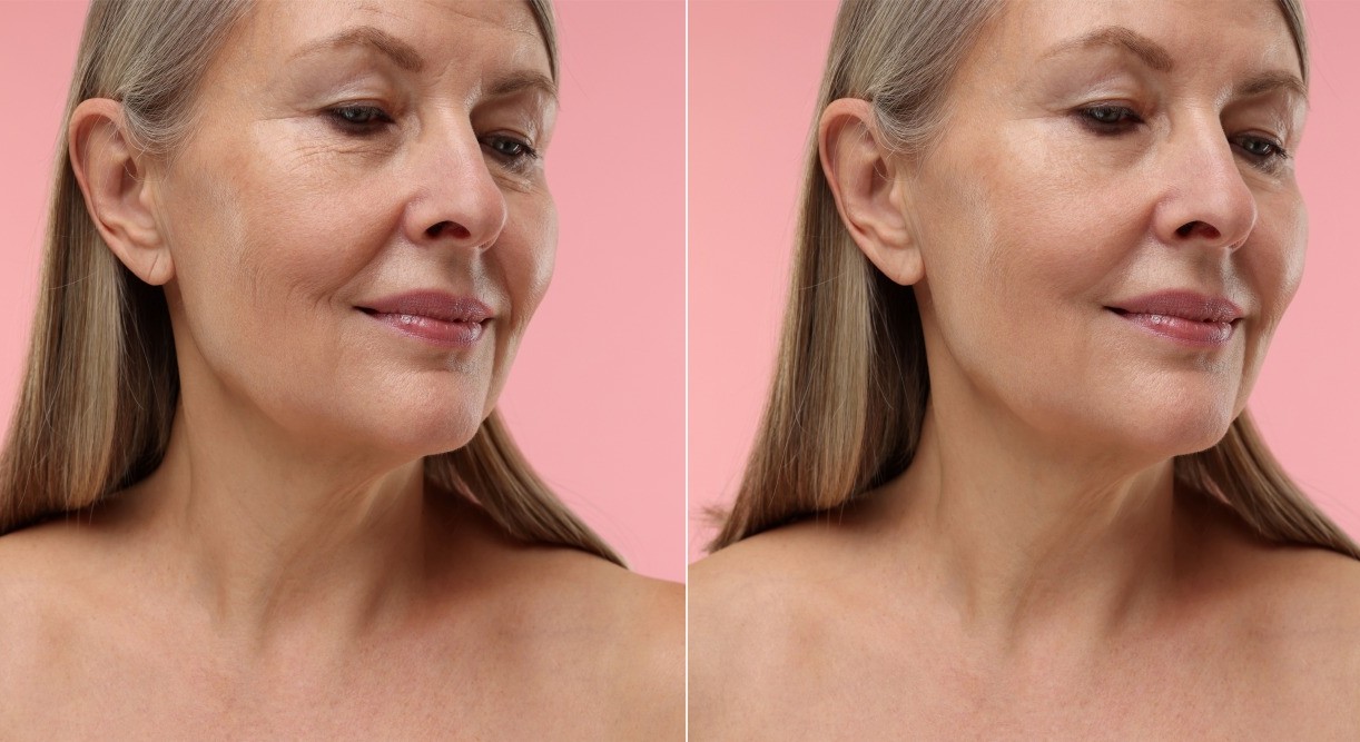 AntiAging2699552355